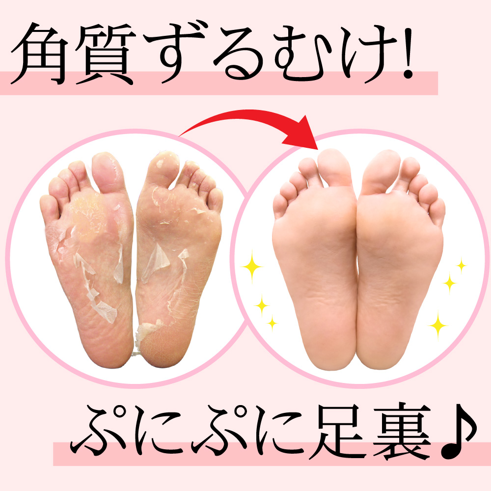 フットピーリングパックペロリン 2回分 足の角質ケア ローズ 美容 コスメ はぴねすくらぶ