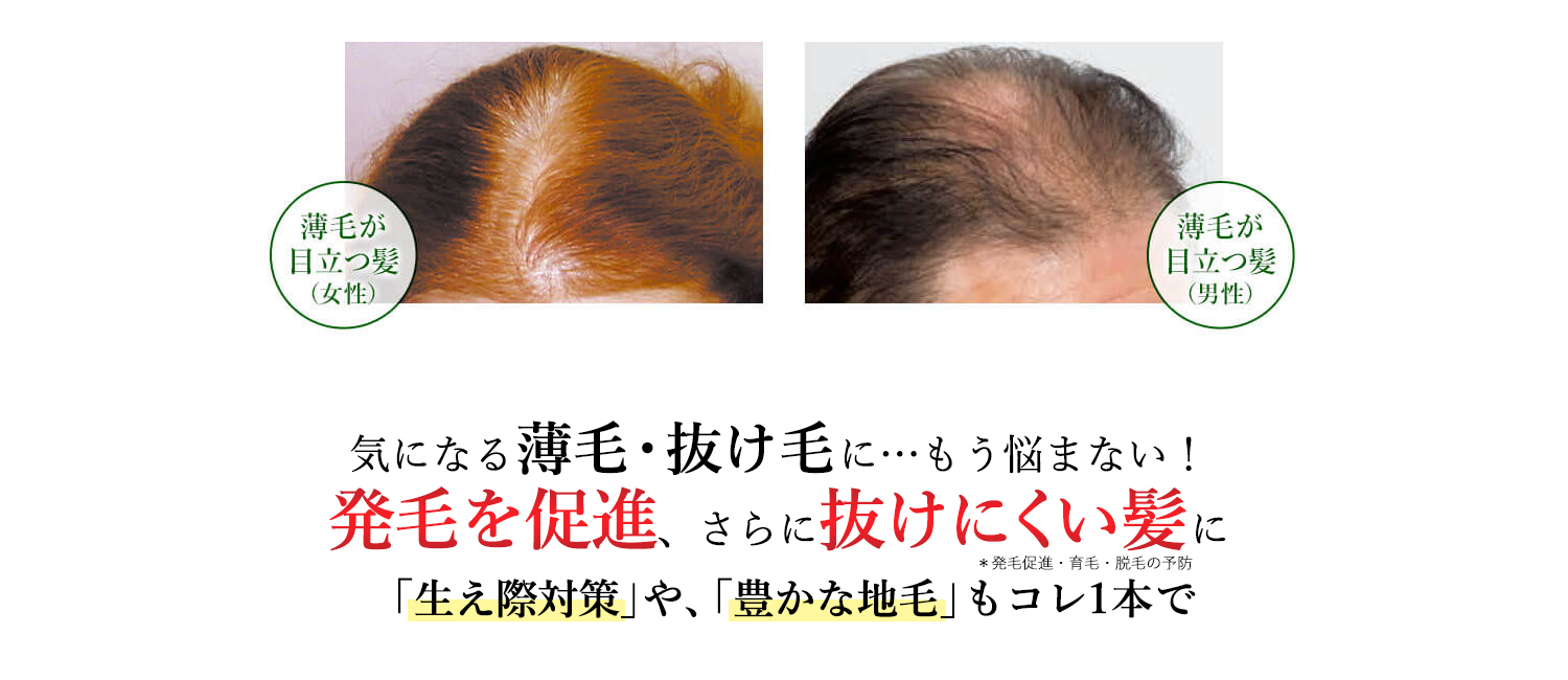 40代・50代・60代・70代 薄毛・抜け毛にお悩みの方に 気になる薄毛・抜け毛に…もう悩まない！発毛を促進し、強く抜けにくい髪に「生え際対策」や、「豊かな地毛」もコレ1本で