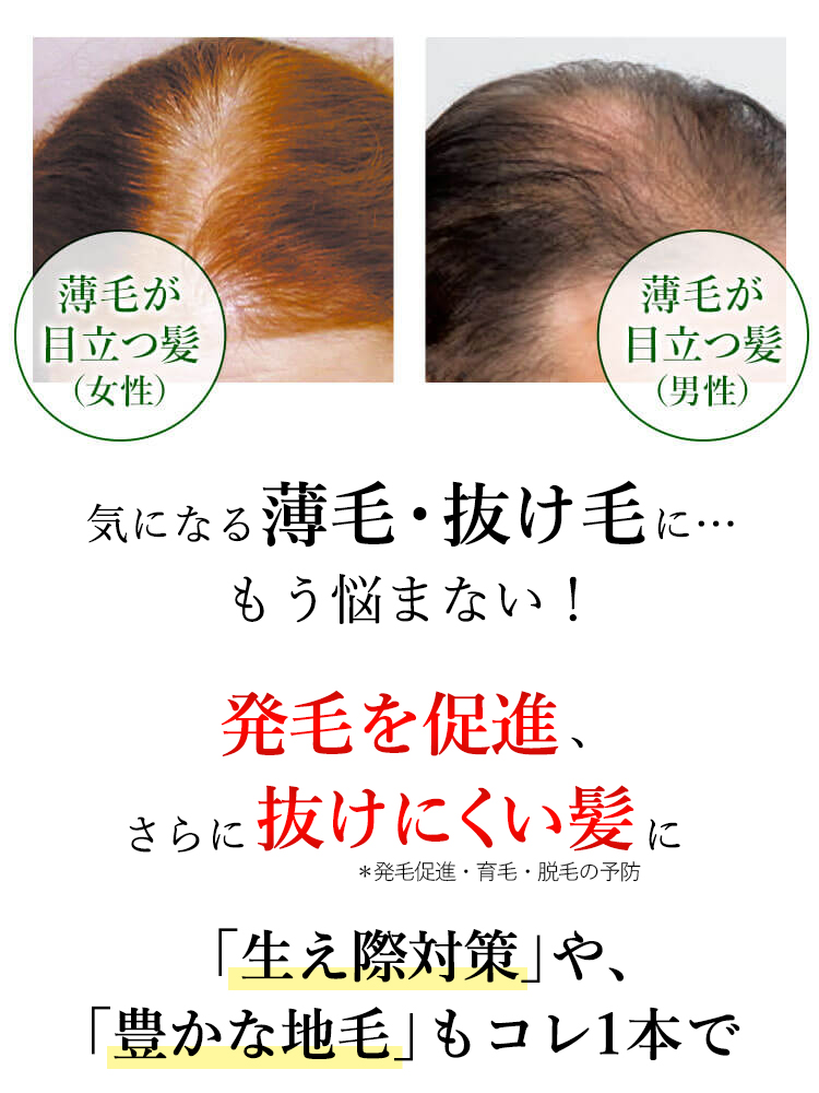 40代・50代・60代・70代 薄毛・抜け毛にお悩みの方に 気になる薄毛・抜け毛に…もう悩まない！発毛を促進し、強く抜けにくい髪に「生え際対策」や、「豊かな地毛」もコレ1本で