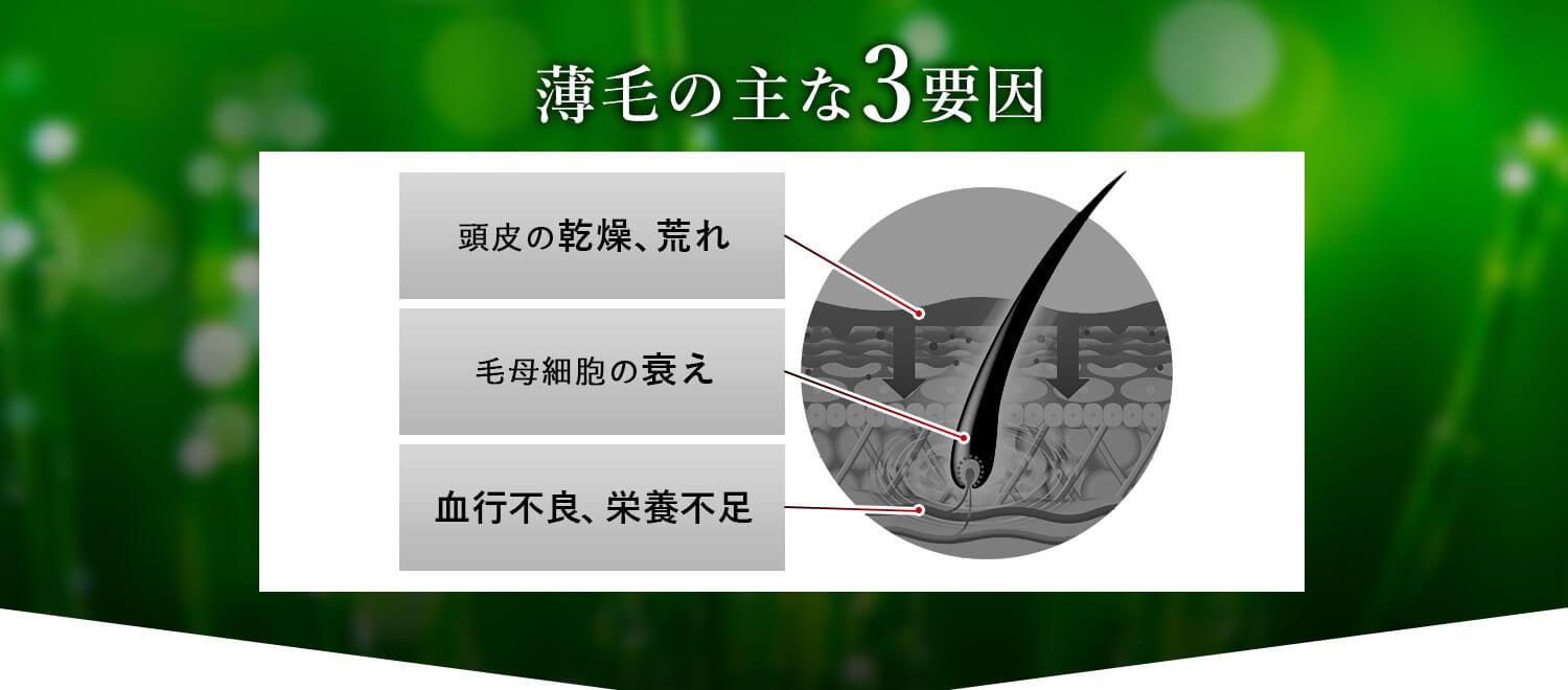 薄毛の主な3要因 頭皮の乾燥、荒れ 毛母細胞の衰え 血行不良、栄養不足