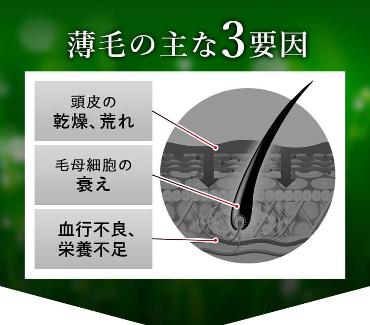 薄毛の主な3要因 頭皮の乾燥、荒れ 毛母細胞の衰え 血行不良、栄養不足