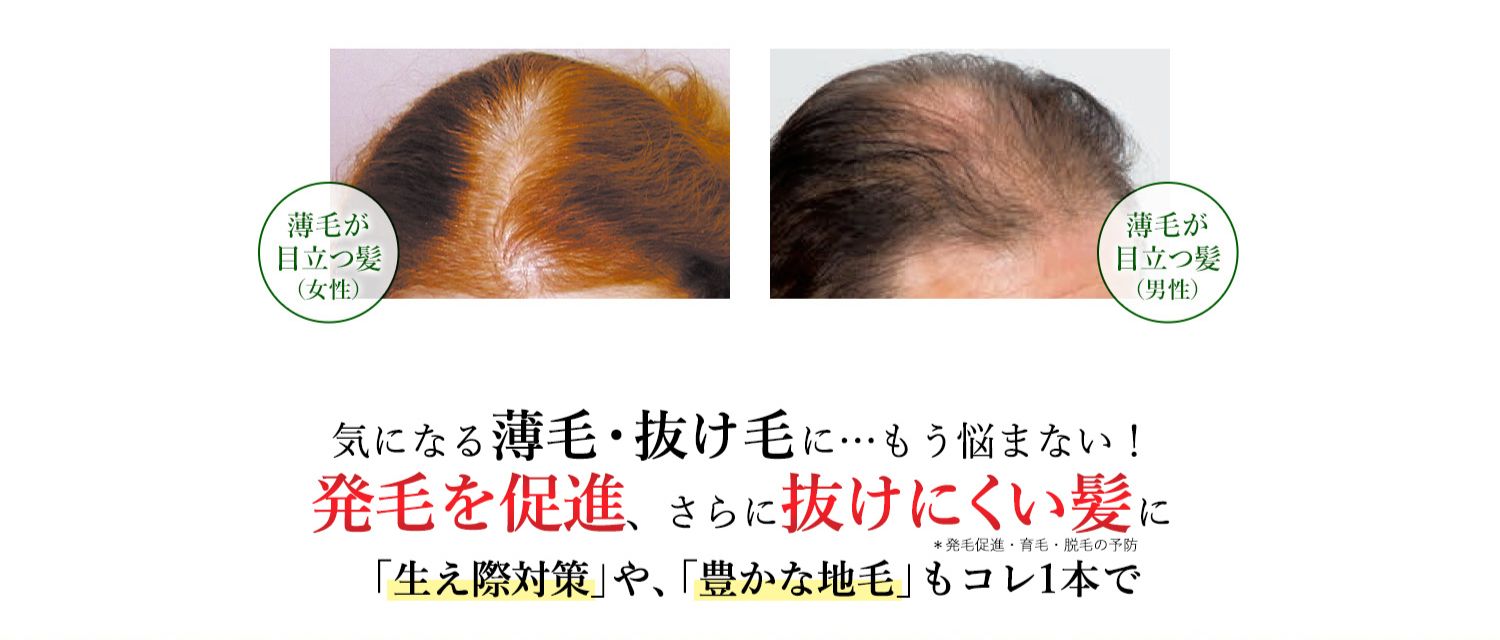 40代・50代・60代・70代 薄毛・抜け毛にお悩みの方に 気になる薄毛・抜け毛に…もう悩まない！発毛を促進し、強く抜けにくい髪に「生え際対策」や、「豊かな地毛」もコレ1本で