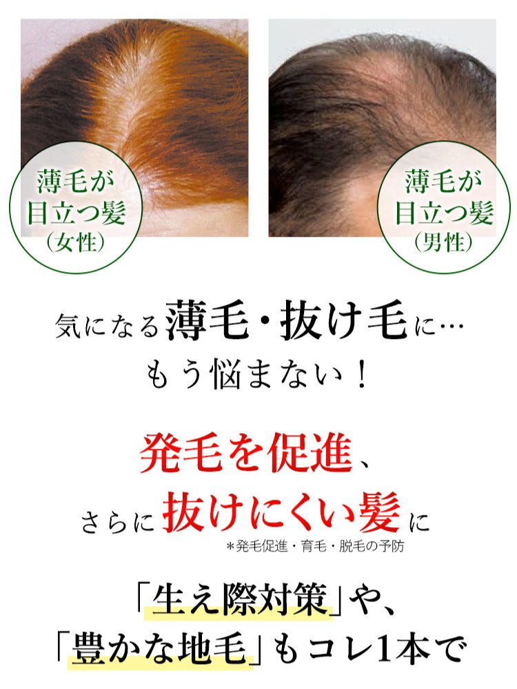 40代・50代・60代・70代 薄毛・抜け毛にお悩みの方に 気になる薄毛・抜け毛に…もう悩まない！発毛を促進し、強く抜けにくい髪に「生え際対策」や、「豊かな地毛」もコレ1本で