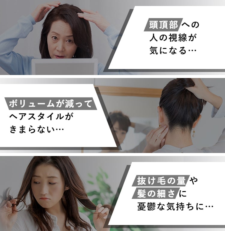 頭頂部への 人の視線が気になる…ボリュームが減って ヘアスタイルがきまらない…抜け毛の量や髪の細さに 憂鬱な気持ちに…
